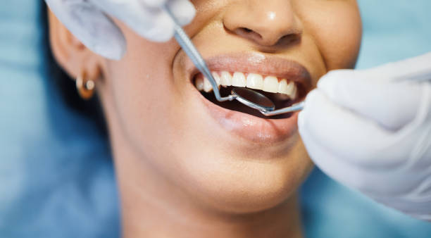 Best Emergency Wisdom Teeth Removal in Ellisville, MS
